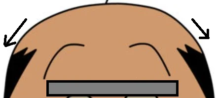 頭皮のたるみによって血行不良が起こり薄毛が進行するイメージ図