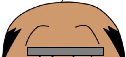 M字型に生え際が後退する男性の薄毛イラスト(はげ始めの特徴)